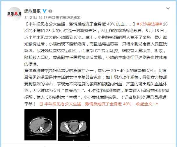 黄体囊肿 黄体囊肿破裂是什么感觉？文章配图