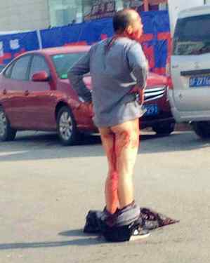 男自宫割下来东西图片 男子自宫后自杀身亡，自宫是割哪里？
