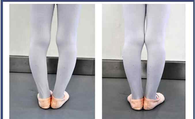 学芭蕾舞腿型对比照片 学芭蕾舞腿型对比照，学芭蕾舞最晚年龄是多大？
