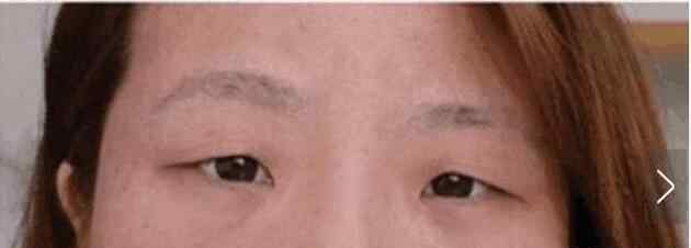 杏核眼 最丑的眼型是什么眼型，怎么判断自己的眼型？