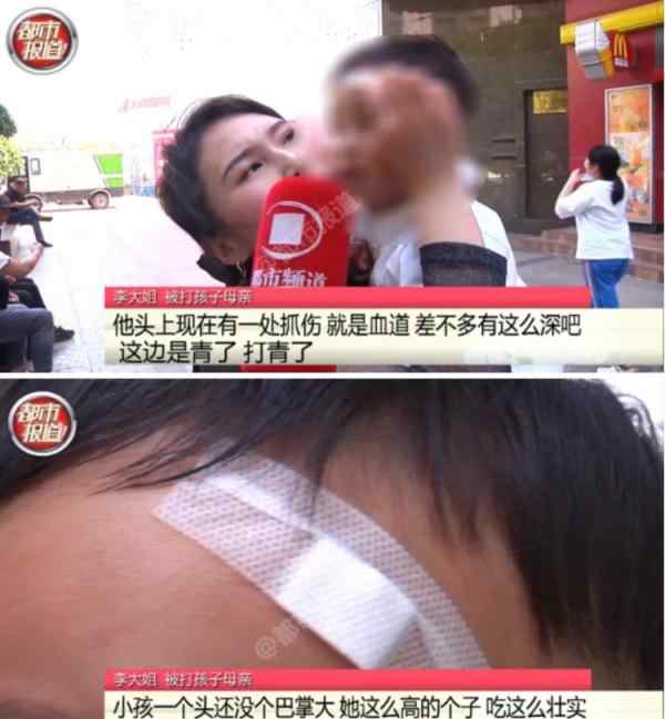 一岁幼儿遭女子“铁砂掌”扇头！母亲也被其抓挠 原因引网友吐槽
