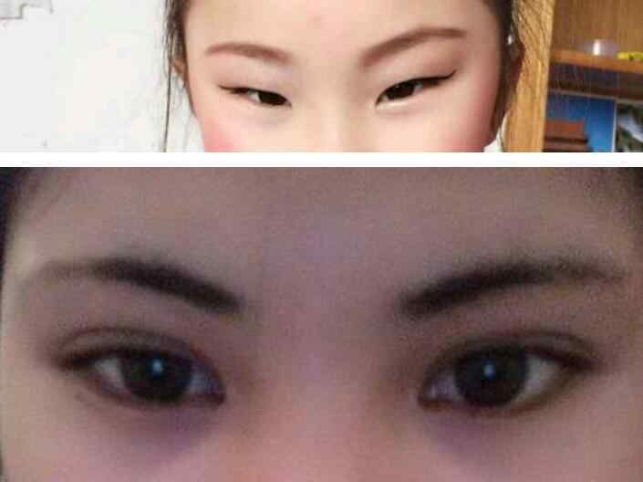 正常的 吊眼怎么变成正常眼睛，女生长吊眼真的不好么?