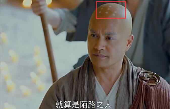 戒疤 和尚烧戒疤仅中国独有真的假的，戒疤最高等级是九点戒疤吗？