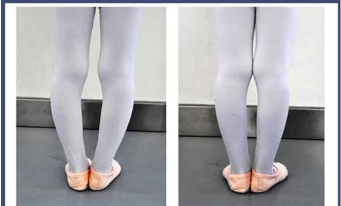 学芭蕾舞最晚年龄 学芭蕾舞腿型对比照，学芭蕾舞最晚年龄是多大？