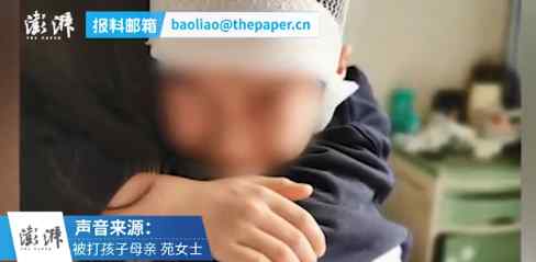 老师揪小学生头发致皮骨分离被拘！为免刑罚曾欲50万私了