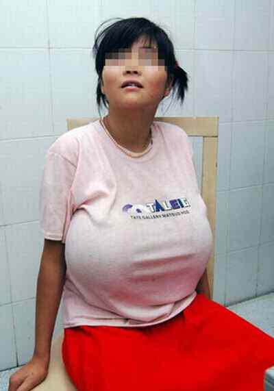 中国波霸 中国第一波霸：胸围1.1米乳房堪比足球