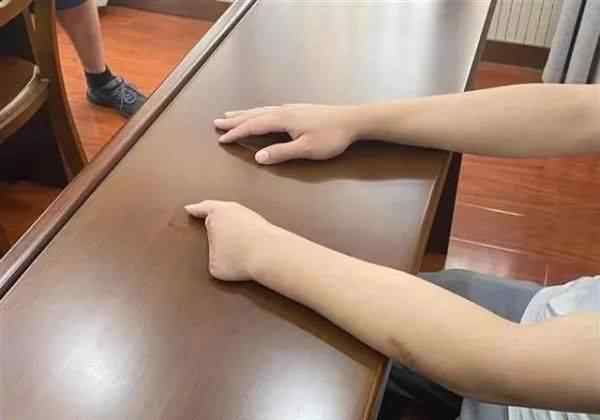 21岁小伙被剁断4根手指 这意味着什么?