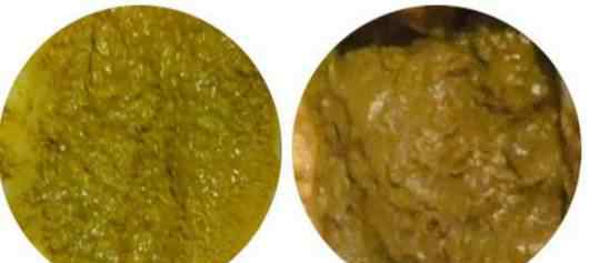 奶瓣屎图片 宝宝奶瓣不用慌,看图知真相