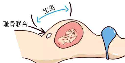 宫高 宫高腹围标准多少？偏高偏低会怎样？文章配图