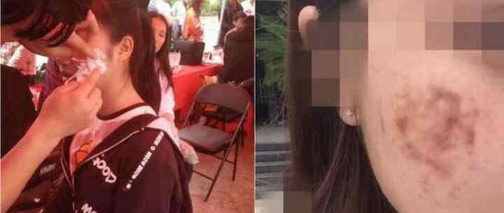南昌多名大学生惨遭毁容事件真相内幕文章配图