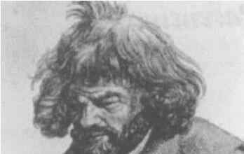 世界十大令人震惊的兽孩 成长经历太吓人了