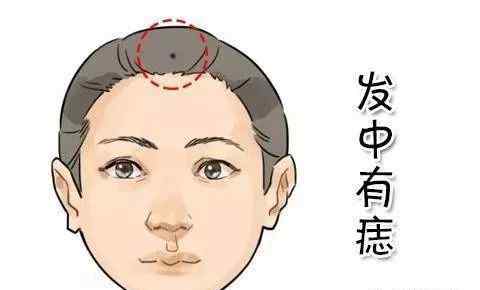看痣算命 看相精髓：“痣相算命”口诀！准确率100%（建议收藏）文章配图