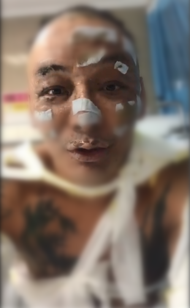 歌手徐真真全身二级深度烧伤 具体事件来龙去脉曝光!!