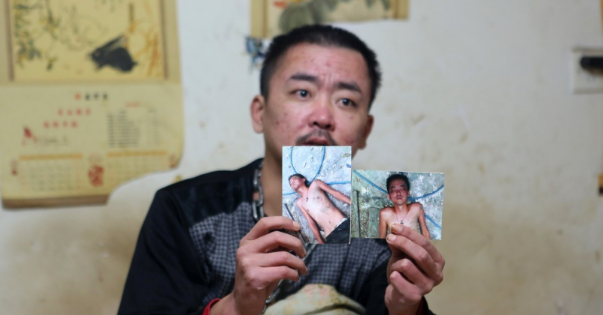 皓轩寻史_安徽小伙嗜酒如命,把妻子和儿子赶走,为戒酒用铁链拴住自己